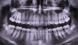 Икар-Дент внедряет новую услугу: Ортопантомограмма челюсти