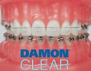 Damon Clear