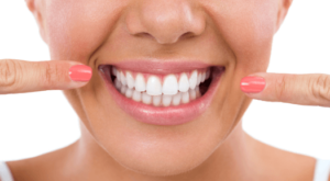 Новая технология в клинике «Икар-Дент» – приводит зубы к сиянию!