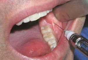 стоматологическое лечение