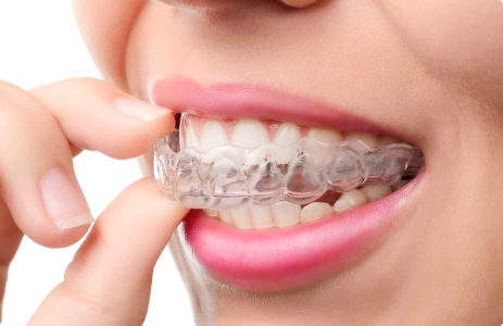 Элайнеры на зубах