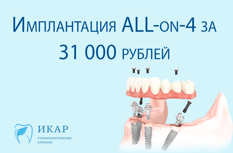 Операция по методике "all-on-4" за 31 000 рублей